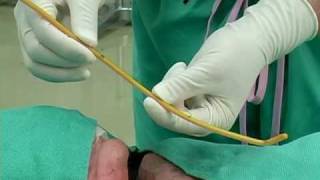 BougieAided Cricothyrotomy by Darren Braude [upl. by Llerut224]