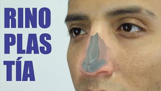 RINOSEPTOPLASTÍA Nariz grande y desviada 👃🏼 RINOPLASTÍA estética y funcional ❤️ Dr PERCY NEVADO [upl. by Naot792]