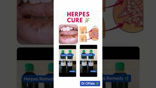 HERPES CURE herpes herpesvirus droffala hsv2 hsv1 hsv genitalherpes holistichealth herbs [upl. by Udella]