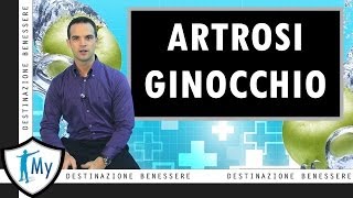 Artrosi del ginocchio [upl. by Tabina]