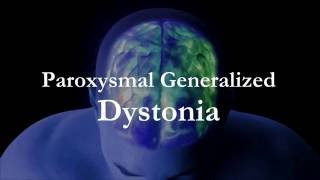 Dr Kukurin Paroxysmal Generalized Dystonia [upl. by Muffin]