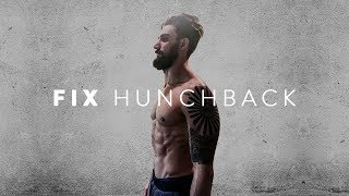 How to fix Hunchback Posture Kyphosis Exercises [upl. by Ssenav228]