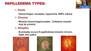 Clinical Grand Rounds in Optic Neuropathies Youve Got Some Nerves [upl. by Aicsila]