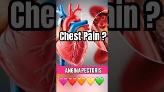 Angina in Tamil  Chest Pain in Tamil  heartattack [upl. by Ecitnirp]