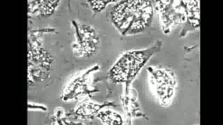 Resistencia a la fagocitosis de Candida [upl. by Gusti]