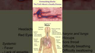 Unmasking Ebola The Truth About a Deadly Disease ebola disease virus [upl. by Imotas337]