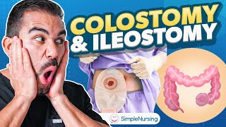 Colostomy and Ileostomy Nursing  Indications Complications Care EASY [upl. by Hardin]