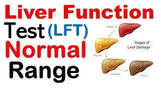 Liver function test normal range [upl. by Helfand814]