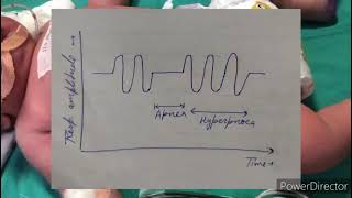 Respiration in children  Pediatrics [upl. by Heron52]