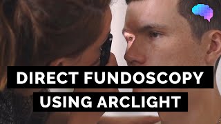 Direct Ophthalmoscopy using Arclight  OSCE Guide  UKMLA  CPSA [upl. by Leoine]