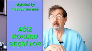 Ağız kokusunda beklenti ve sık yapılan hatalar geçmeyen ağız kokusu iyileşmeyen nefes kokusu [upl. by Holsworth759]