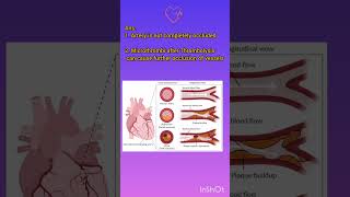 Why is Thrombolysis Contraindicated in STEMI myocardialinfarction myocarditis [upl. by Aneleve214]