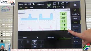 Alarm Function  Elisa ICU Ventilator [upl. by Eedoj]