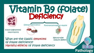 Folate deficiency  What are the symptoms of low folic acid  Harmful effects of Folate deficiency [upl. by Matless423]