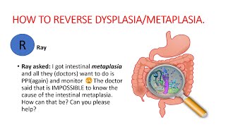 Metaplasia dysplasia How to reverse dysplasia metaplasia Natural treatment [upl. by Doowron818]