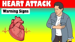 Warning Signs Of A Heart Attack Heart Attack  Warning Signs [upl. by Nimra]