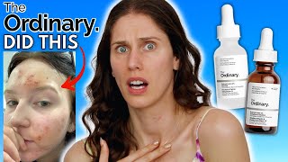 WHAT HAPPENED TO THE ORDINARYS SALICYLIC ACID VS THE NEW SALICYLIC ACID ANHYDROUS SOLUTION [upl. by Laeynad]