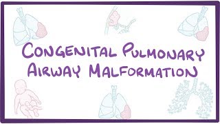 Congenital pulmonary airway malformation  an Osmosis preview [upl. by Red]