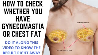 HOW TO KNOW WHETHER YOU HAVE CHEST FAT OR GYNECOMASTIA DO A TEST NOW AS SHOWN IN THIS VIDEOSIMPLE [upl. by Guthrie350]