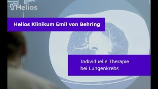 Individuelle Therapie bei Lungenkrebs [upl. by Millur]