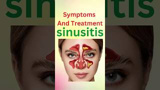 What is Chronic Sinusitis [upl. by Rafaj607]