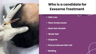 Exosome Treatment l Hair Loss l Balding l Hair Fall l Twacha l Dwarka l Delhi [upl. by Iduj2]