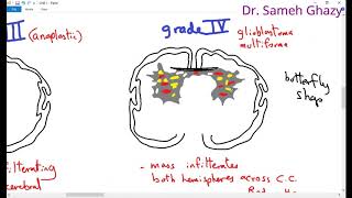 Systemic pathology 15  CNS 1 tumors of CNS  DRSAMEH GHAZY [upl. by Julide]