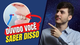 Duvido você conhecer ISSO  Escova interdental  Periodontia [upl. by Ramoh]