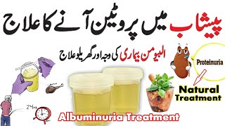 Treatment of Albumin in urine  Peshab Main Protein Anay Ka Ilaj  Albumin treatment  Protein lose [upl. by Cynthea]