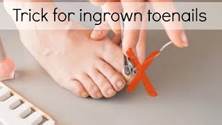 How to Fix Ingrown Toenails Easily [upl. by Lonyer]