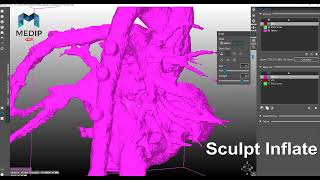 MEDIP 기능 구동 보기 Mesh Brush Sculpt [upl. by Amsab]