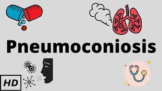 Pneumoconiosis Causes Signs and Symptoms Diagnosis and Treatment [upl. by Nelav17]