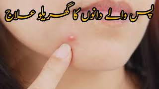 how to get rid pus filled pimples pus waly dano ka ilaj  how to remove pimples [upl. by Mikael679]