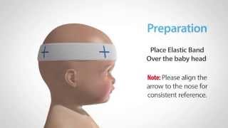 Using our Craniometer to Measure and Monitor Flat Head Syndrome [upl. by Euqirne]