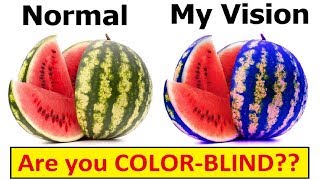 DIFFERENT TYPES of COLORBLINDNESS [upl. by Piegari]