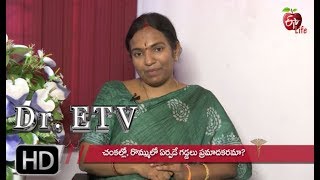 Swollen Lymph Nodes  Dr ETV  30th May 2019  ETV Life [upl. by Araec]