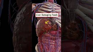 5 Foods Damaging Your Liver ☠️  health liver wellness healthtips shorts [upl. by Irap]