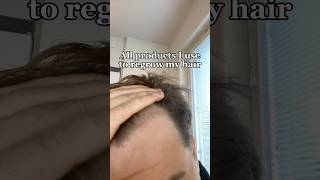 These Products Helped Me Regrow My Hair [upl. by Almena508]