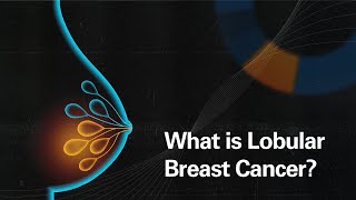 What is Lobular Breast Cancer [upl. by Valtin]