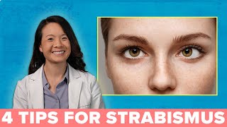 4 Great Ways to Treat Your Strabismus [upl. by Amil]