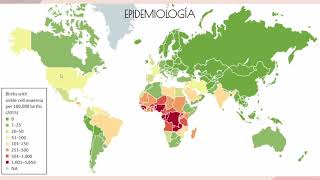 20210218  Anemia de células falciformes [upl. by Auberon]