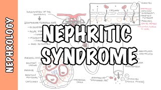 Nephritic Syndrome  classification pathophysiology treatment RPGN ANCA Immune complex [upl. by Doretta]