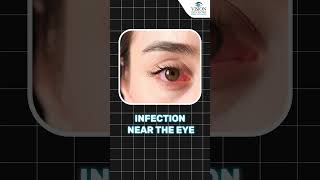 Safe Eye Makeup After LASIK Surgery  Tips for Safe Eye Makeup After LASIK Surgery [upl. by Maise]