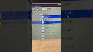 For MRI Techs How to perform manual subtractions on MRI scanner [upl. by Ellohcin]