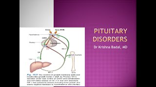 Pituitary disorders Tumors and acromegaly [upl. by Eixela]