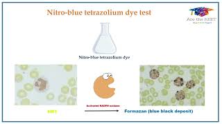 Nitroblue Tetrazolium test  NEETMDS  INICET AcetheNEET [upl. by Assenov]