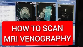 Venography MRI scan Protocol Live Demo on GE 15 Tesla  MRV Brain  Easy Technique [upl. by Dlaniger]