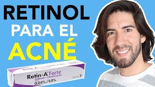 MI EXPERIENCIA CON EL RETINOL PARA ACNÉ Y CICATRICES  JM Montaño [upl. by Markus]