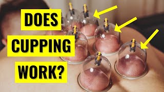 Does Cupping Therapy ACTUALLY Work [upl. by Durston]