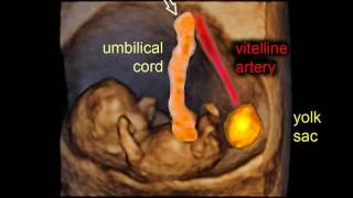 9 weeks of pregnancy gestational sac and embryo  3D scan [upl. by Kristian982]